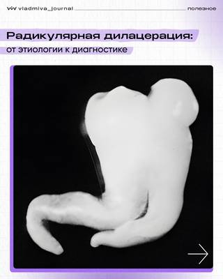 Дилацерация: делимся находками в комментариях.